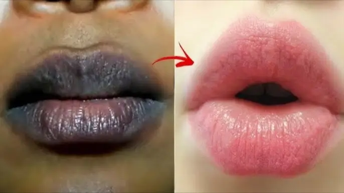 होंठों को गुलाबी बनाने वाले 5 जादुई फूड्स और घरेलू नुस्खा